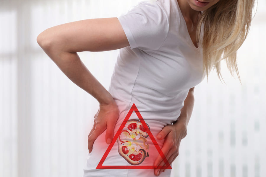 Đau thận là gì? Những nguyên nhân nào gây đau thận.