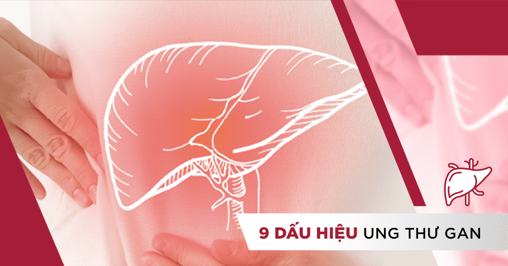 9 dấu hiệu ung thư gan giúp bạn phát hiện bệnh sớm.