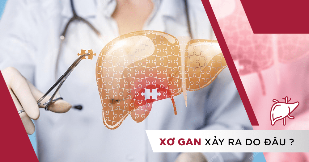 Xơ gan là gì? Xơ gan xảy ra do đâu?